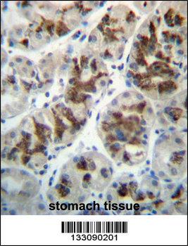 CTGF Antibody (Center)