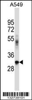 BNIP2 Antibody (C-term)