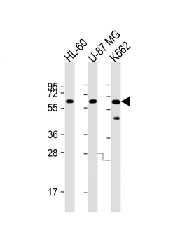 IL1RL2 Antibody (Center)