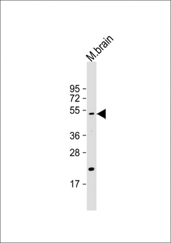 HtrA1 Antibody (N-term)