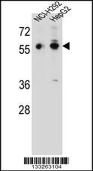 TRIM64 Antibody (C-term)