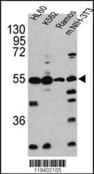 CASP2 Antibody (Center)