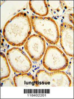 CASP2 Antibody (Center)