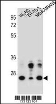 GFRA4 Antibody (Center)