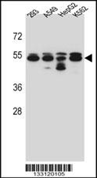 TUBB8 Antibody (N-term)