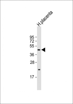 SGPP1 Antibody (N-term)