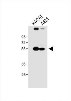 SGPP1 Antibody (N-term)