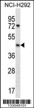 SGPP1 Antibody (N-term)