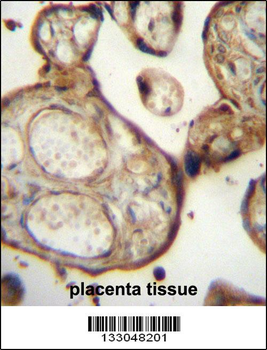 SGPP1 Antibody (N-term)