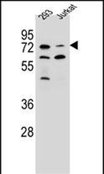 SLC9A6 Antibody (C-term)