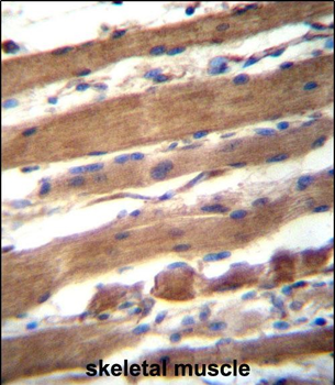 SLC9A6 Antibody (C-term)