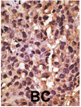 BNIP3 Antibody (BH3 Domain Specific)