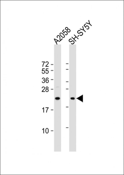 FGF11 Antibody (N-term)