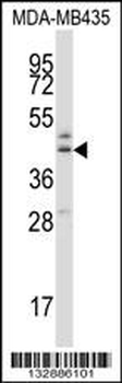B3GNT1 Antibody (C-term)