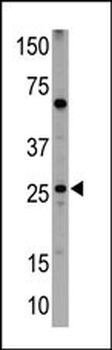 NIP1 Antibody (BH3 Domain Specific)