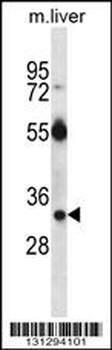 RASD1 Antibody (C-term)