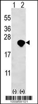 Bid Antibody (BH3 Domain Specific)