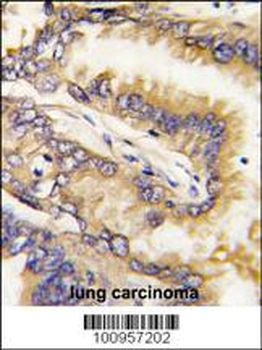 Bid Antibody (BH3 Domain Specific)