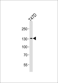 ATAD2 Antibody (N-term)