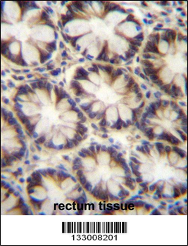 LNX2 Antibody (C-term)