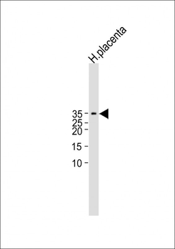 CGB/HCG-Beta Antibody (C-term)
