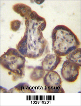 CGB/HCG-Beta Antibody (C-term)