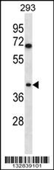 TOR1B Antibody (C-term)