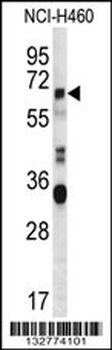 HERV-FRD Antibody (N-term)