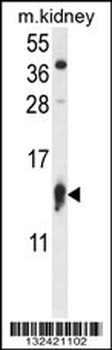 RPS12 Antibody (N-term)