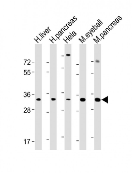 SFRP5 Antibody (Center)