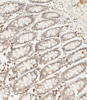 SFRP5 Antibody (Center)