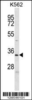 ELAVL2 Antibody (Center)