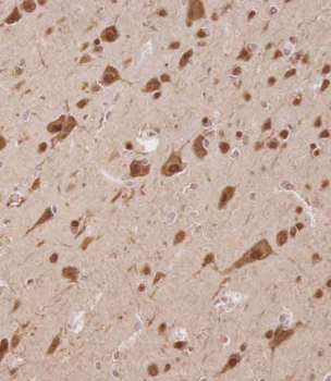 ELAVL2 Antibody (Center)