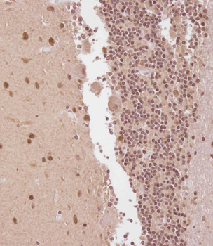 ELAVL2 Antibody (Center)