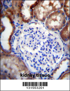 LINGO4 Antibody (C-term)