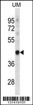 TRUB1 Antibody (Center)