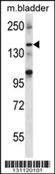 SHANK2 Antibody (Center)
