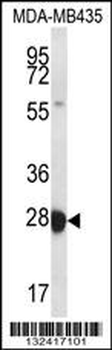 RAB27B Antibody (Center)