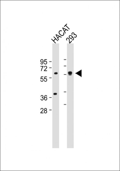SGPL1 Antibody (N-term)