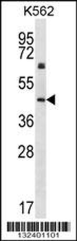 KRT12 Antibody (C-term)