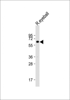KRT12 Antibody (C-term)