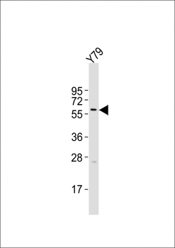 KRT12 Antibody (C-term)
