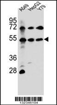FGFRL1 Antibody (N-term)