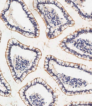 SLC23A1 Antibody (N-term)