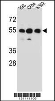 ZNF562 Antibody (N-term)