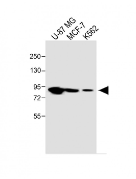 PLOD1 Antibody (N-term)