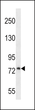 PLOD1 Antibody (N-term)