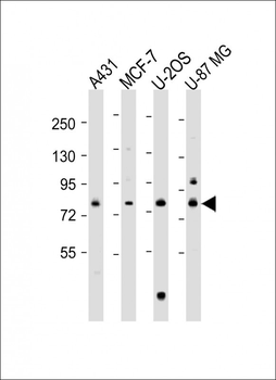 PLOD1 Antibody (N-term)