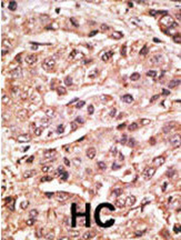 SUMO4 Antibody (V55 Mutant)