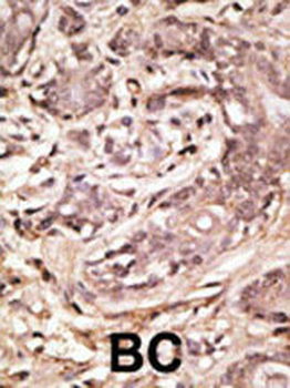 SUMO4 Antibody (M55 Wild type)
